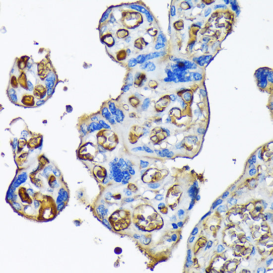Alpha-2-Macroglobulin (A2M) Rabbit mAb