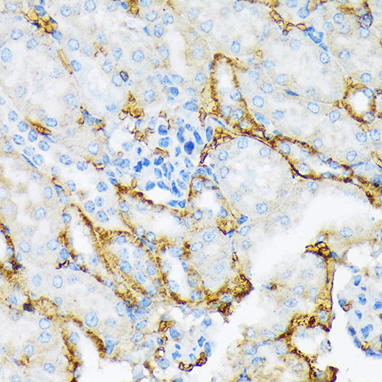 Alpha-2-Macroglobulin (A2M) Rabbit mAb