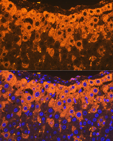 Alpha-2-Macroglobulin (A2M) Rabbit mAb