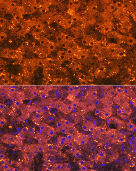 Alpha-2-Macroglobulin (A2M) Rabbit mAb
