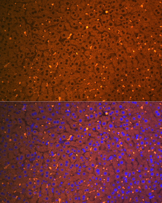 Alpha-2-Macroglobulin (A2M) Rabbit mAb
