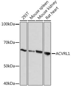 ACVRL1 Rabbit mAb