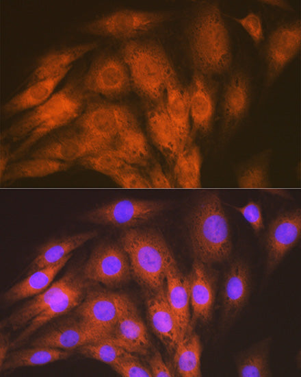 ACVRL1 Rabbit mAb