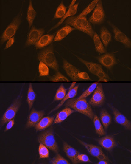 ACVRL1 Rabbit mAb