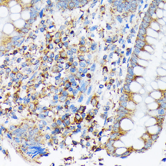 CDC25B Rabbit mAb