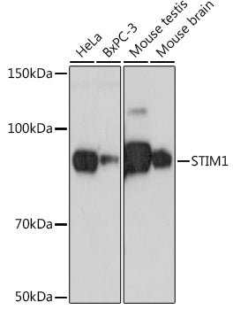 STIM1 Rabbit mAb