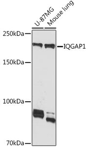 IQGAP1 Rabbit mAb
