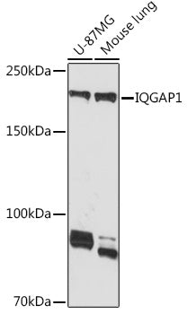 IQGAP1 Rabbit mAb