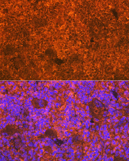CD3D Rabbit mAb