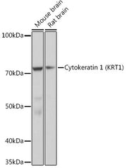 Cytokeratin 1 (KRT1) Rabbit mAb