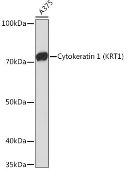 Cytokeratin 1 (KRT1) Rabbit mAb