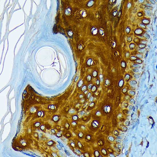 Cytokeratin 1 (KRT1) Rabbit mAb