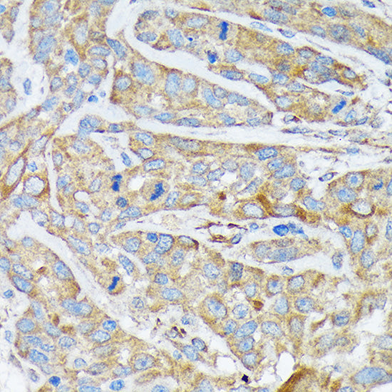 Cytokeratin 1 (KRT1) Rabbit mAb