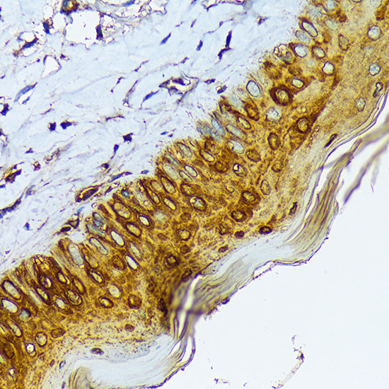 Cytokeratin 1 (KRT1) Rabbit mAb