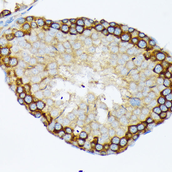 USP9X Rabbit mAb