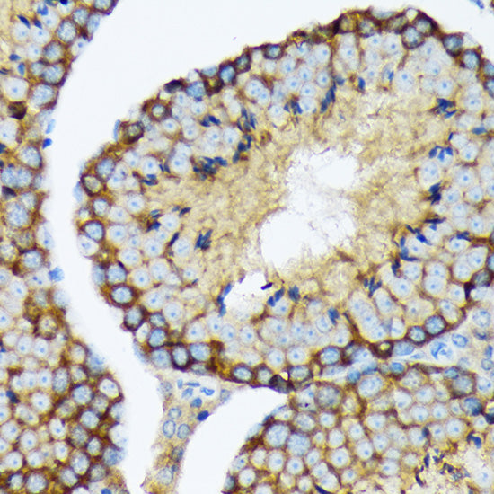 USP9X Rabbit mAb
