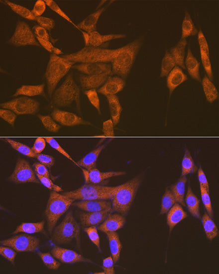 USP9X Rabbit mAb