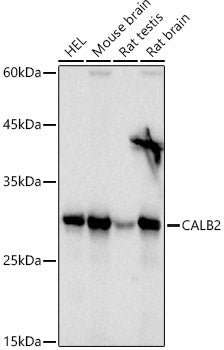 Calretinin Rabbit pAb