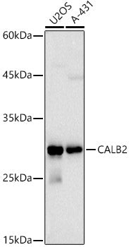 Calretinin Rabbit pAb