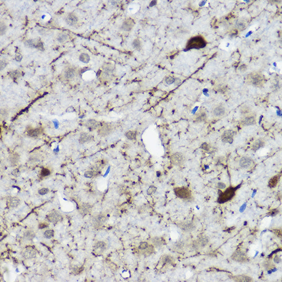 Calretinin Rabbit pAb