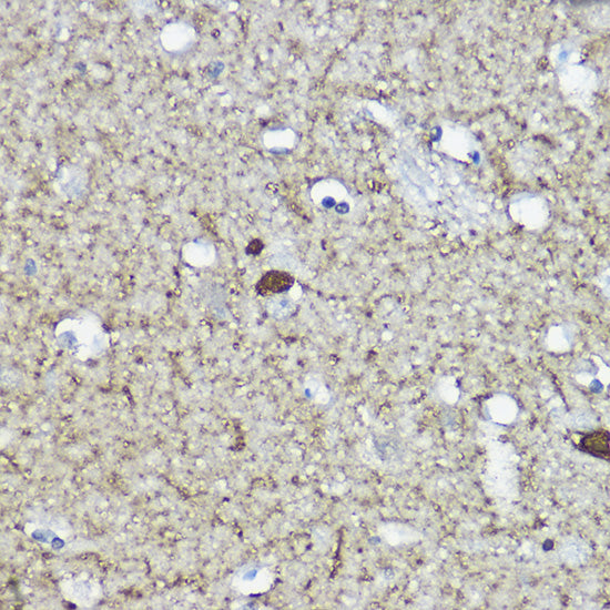 Calretinin Rabbit pAb
