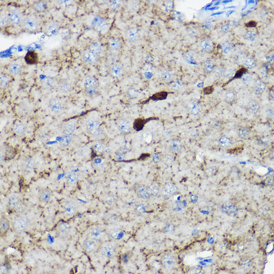 Calretinin Rabbit pAb