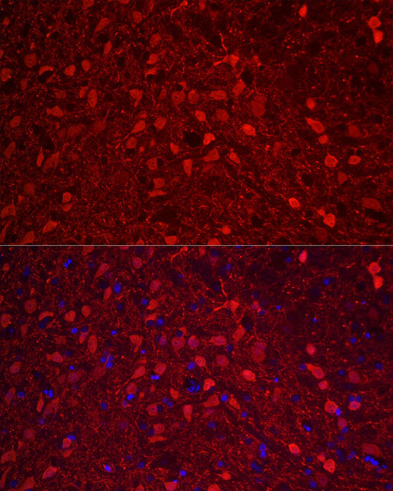 Calretinin Rabbit pAb