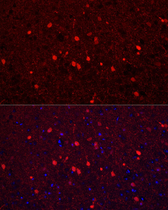 Calretinin Rabbit pAb