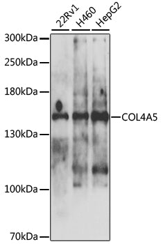 COL4A5 Rabbit pAb