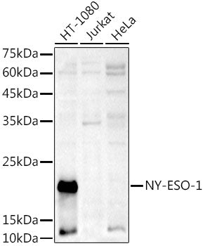 NY-ESO-1 Rabbit pAb