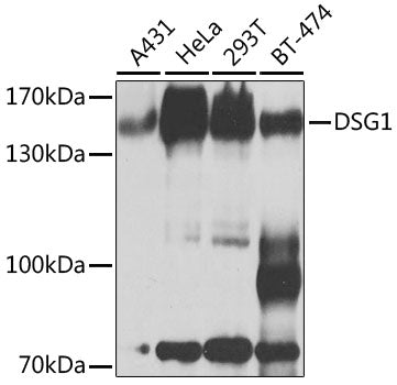 DSG1 Rabbit pAb