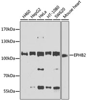 EPHB2 Rabbit pAb