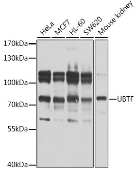UBTF Rabbit pAb
