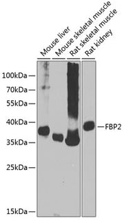 FBP2 Rabbit pAb