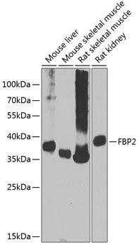 FBP2 Rabbit pAb