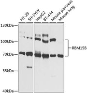 RBM15B Rabbit pAb