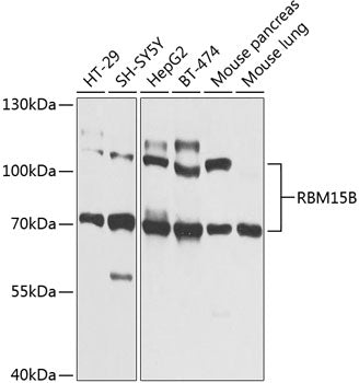 RBM15B Rabbit pAb