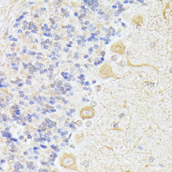 KAT9/Elp3 Rabbit pAb