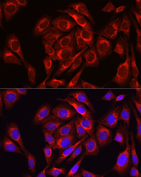 Mitofusin-1/MFN1 Rabbit pAb