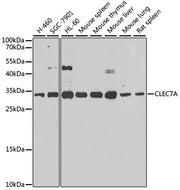 CLEC7A Rabbit pAb