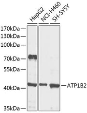 ATP1B2 Rabbit pAb