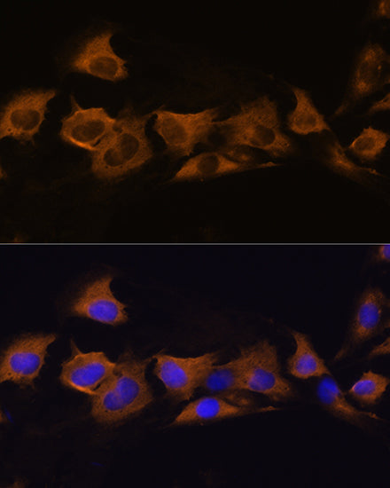 ATP1B2 Rabbit pAb