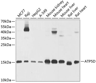 ATP5D Rabbit pAb