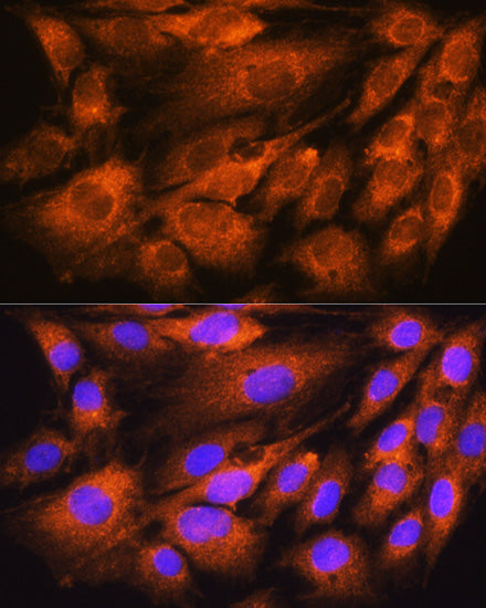 ATP5D Rabbit pAb