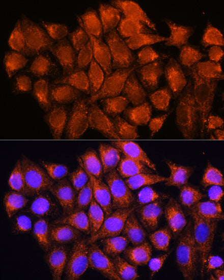 ATP5D Rabbit pAb