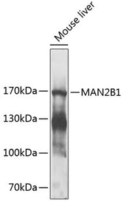 MAN2B1 Rabbit pAb