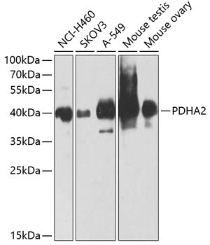 PDHA2 Rabbit pAb