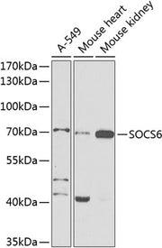 SOCS6 Rabbit pAb