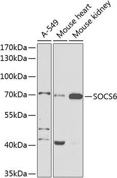 SOCS6 Rabbit pAb