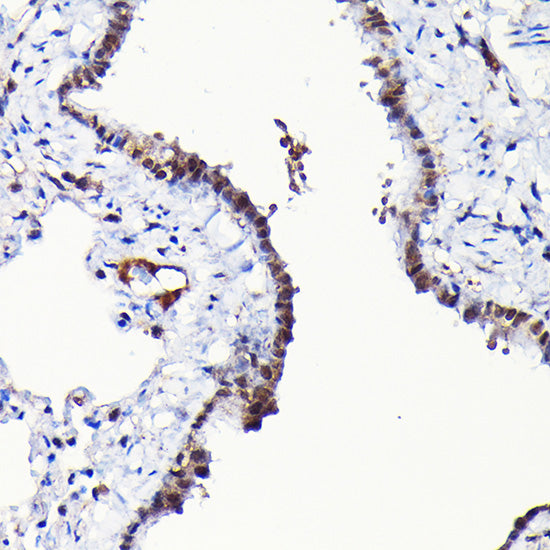RGS14 Rabbit pAb